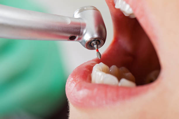 Best Knocked-Out Tooth Emergency  in Kenai, AK